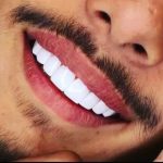 دندان پزشکی،دندان سازی و کامپوزیت زیبایی دندان