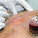 تزریقات ، سرمتراپی ، مزوتراپی مو ، صورت و غب غب  ، انواع آزمایش ، فیزوتراپی  ، پانسمان ، سونداژ ، فصد خون در منزل « ویزیت در محل و منزل »  « بصورت شبانه روزی »
