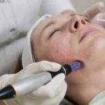 تزریقات ، سرمتراپی ، مزوتراپی مو ، صورت و غب غب  ، انواع آزمایش ، فیزوتراپی  ، پانسمان ، سونداژ ، فصد خون در منزل « ویزیت در محل و منزل »  « بصورت شبانه روزی »
