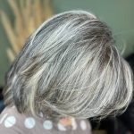 ترمیم دکلره امبره با آلیاژ فوق روشن