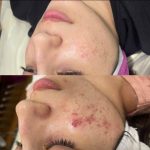 پاکسازی صورت