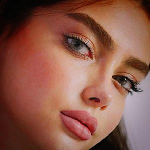 عمل جراحی بینی و پیکر تراشی،جشنواره تابستان تخفیف ۳۰٪