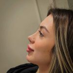 عمل جراحی بینی و پیکر تراشی،جشنواره تابستان تخفیف ۳۰٪